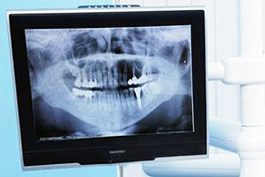 Digital X-ray | Roslindale Village Dental | Roslindale, MA 02131 | Aliakbar Esmaeili DDS